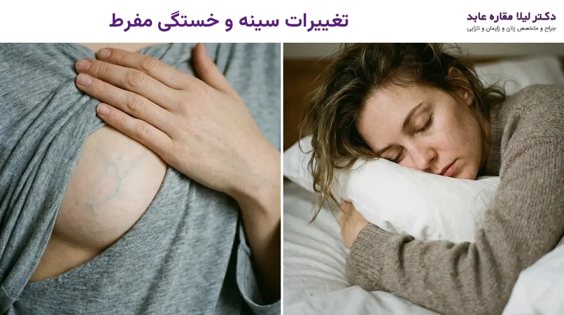 تغییرات سینه و خستگی مفرط