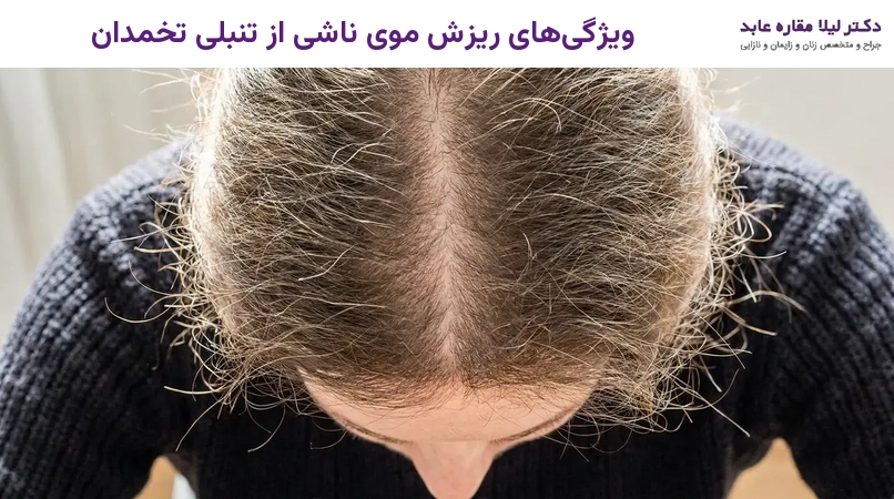 ویژگیهای ریزش موی ناشی از تنبلی تخمدان