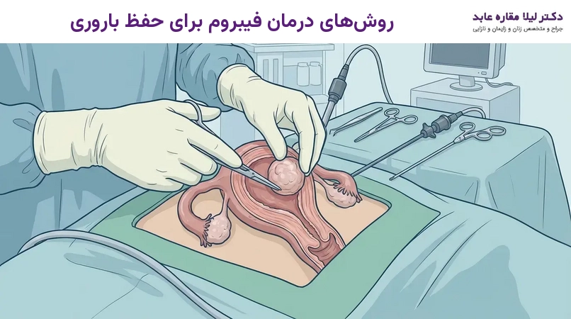 روش‌های درمان فیبروم برای حفظ باروری