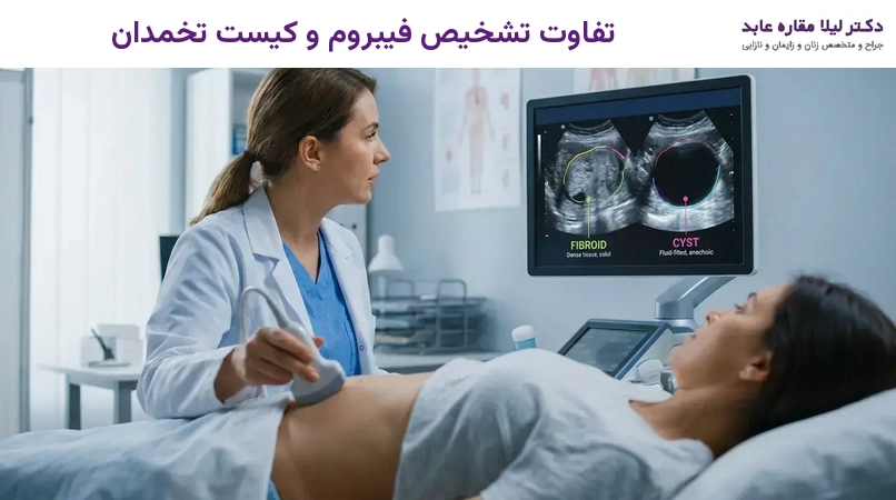 تفاوت تشخیص فیبروم و کیست تخمدان