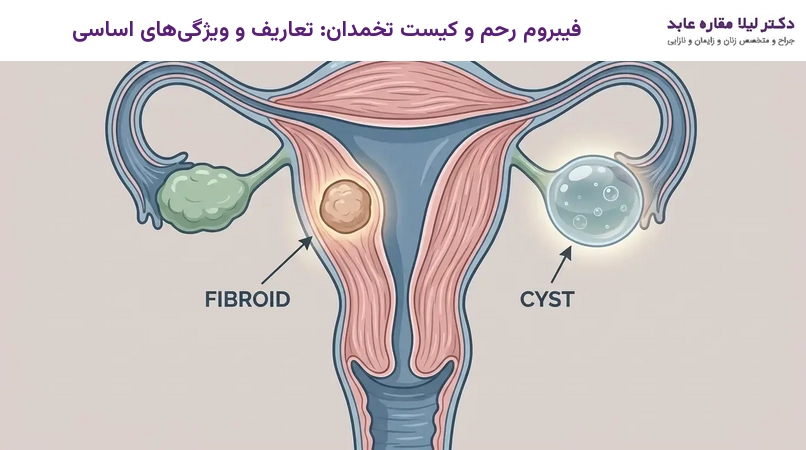 فیبروم رحم و کیست تخمدان: تعاریف و ویژگی‌های اساسی