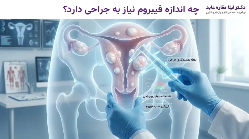 چه اندازه فیبروم نیاز به جراحی دارد؟