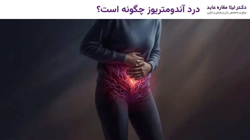 درد آندومتریوز چگونه است؟
