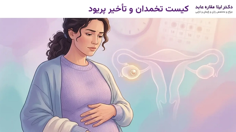 کیست تخمدان و تأخیر پریود
