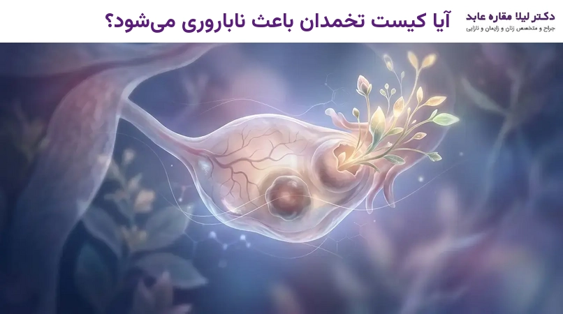 آیا کیست تخمدان باعث ناباروری می‌شود؟