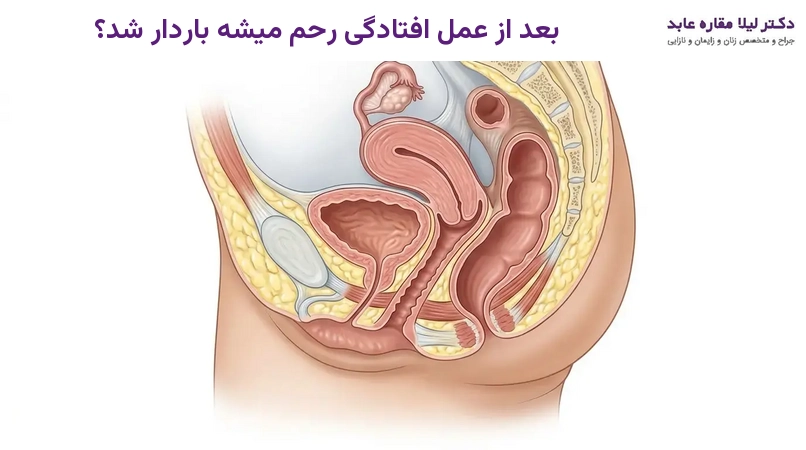 بعد از عمل افتادگی رحم میشه باردار شد؟
