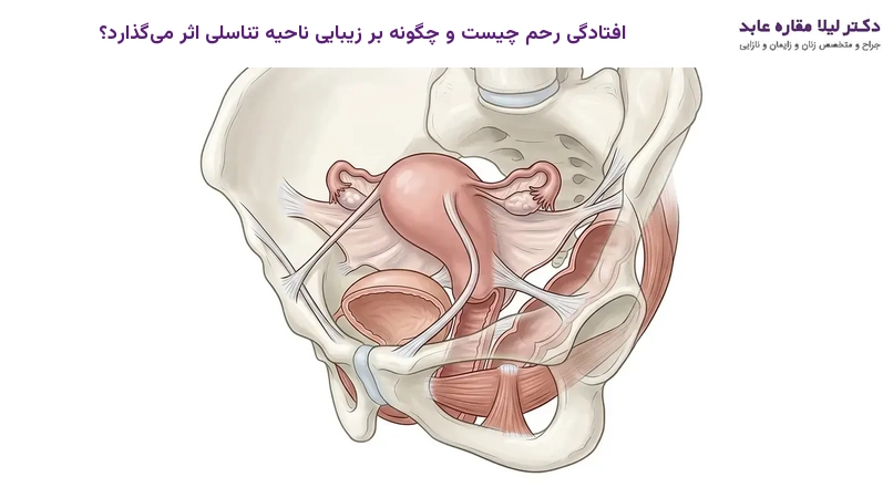 افتادگی رحم چیست و چگونه بر زیبایی ناحیه تناسلی اثر می‌گذارد؟