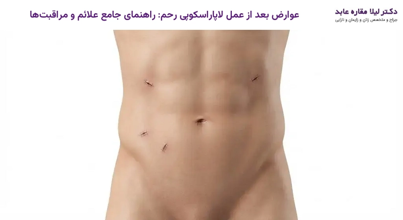 عوارض بعد از عمل لاپاراسکوپی رحم: راهنمای جامع علائم و مراقبت‌ها