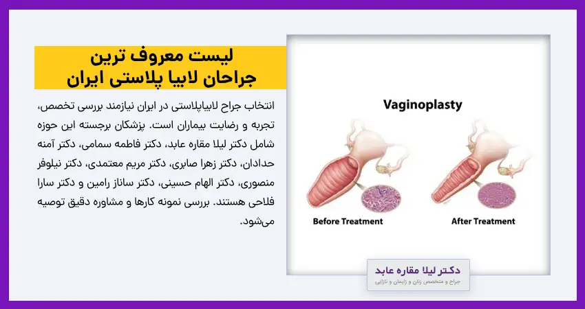 لیست معروف ترین جراحان لابیا پلاستی ایران 