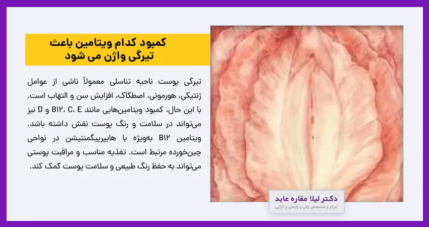 کمبود کدام ویتامین باعث تیرگی واژن می شود