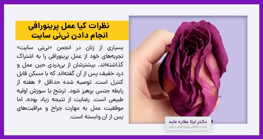 نظرات کیا عمل پرینورافی انجام دادن نی‌نی سایت