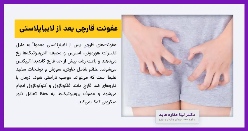 عفونت قارچی بعد از لابیاپلاستی