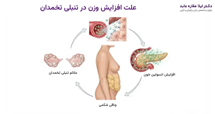علت افزایش وزن در تنبلی تخمدان