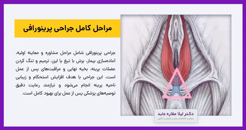 مراحل کامل جراحی پرینورافی