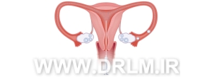 iui موفق