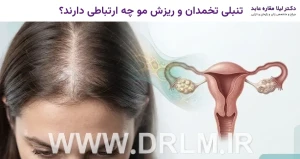 تنبلی تخمدان و ریزش مو چه ارتباطی دارند؟