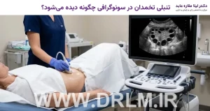تنبلی تخمدان در سونوگرافی چگونه دیده می‌شود؟