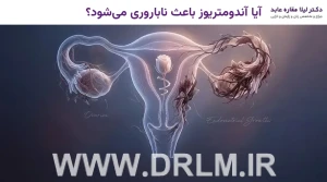 آیا آندومتریوز باعث ناباروری می‌شود؟