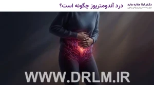 درد آندومتریوز چگونه است؟