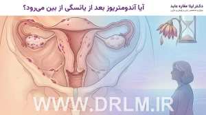 آیا آندومتریوز بعد از یائسگی از بین می‌رود؟