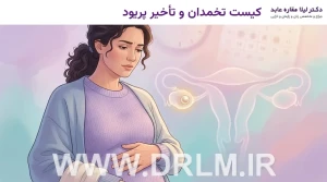 کیست تخمدان و تأخیر پریود