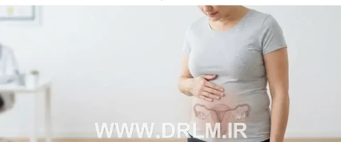 آیا تنبلی تخمدان باعث چاقی می‌شود؟