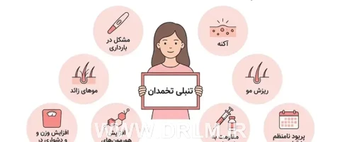 علائم تنبلی تخمدان در دختران مجرد